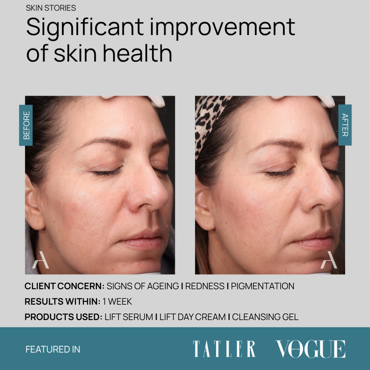 Cleansing Gel