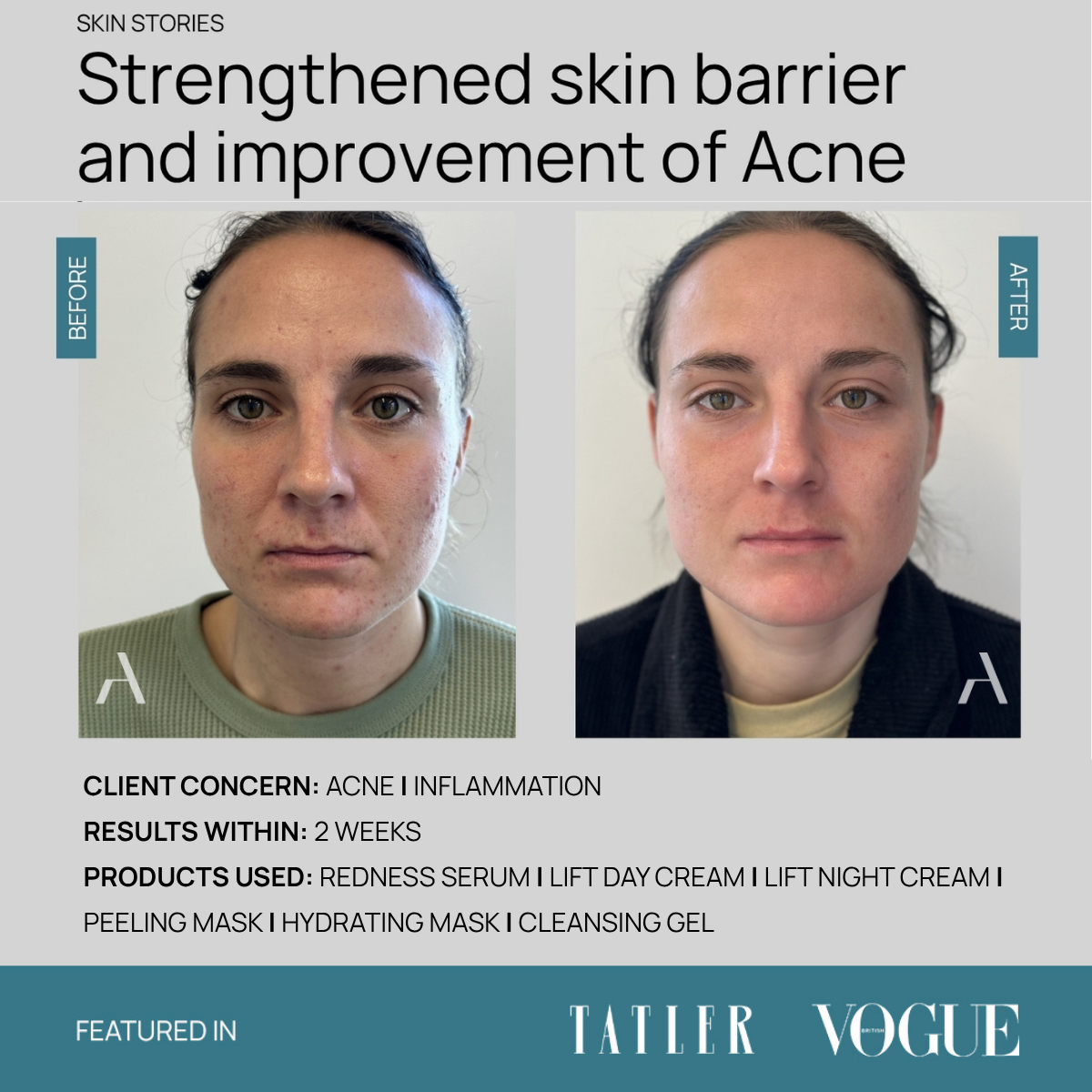 Lift Day Cream