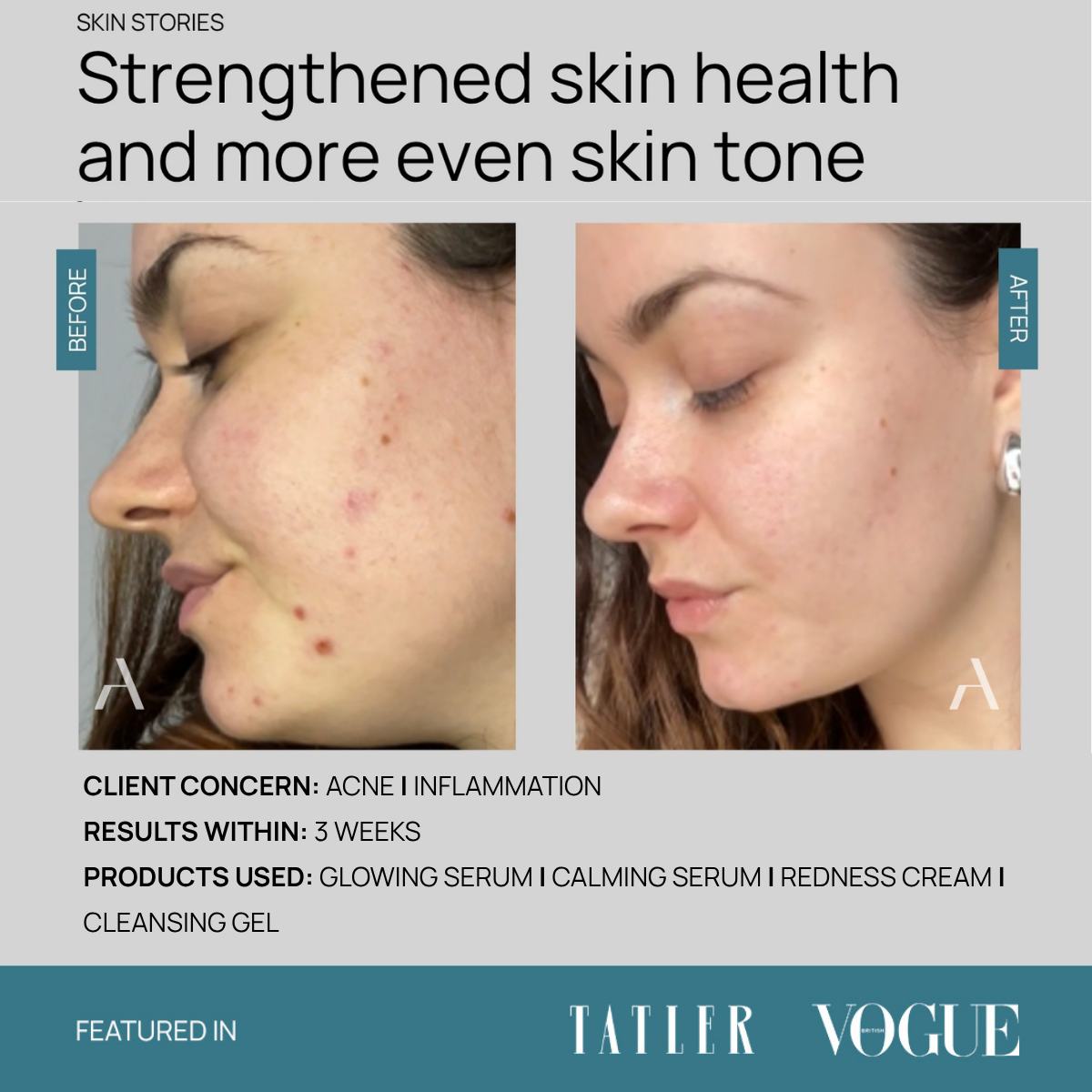 Cleansing Gel