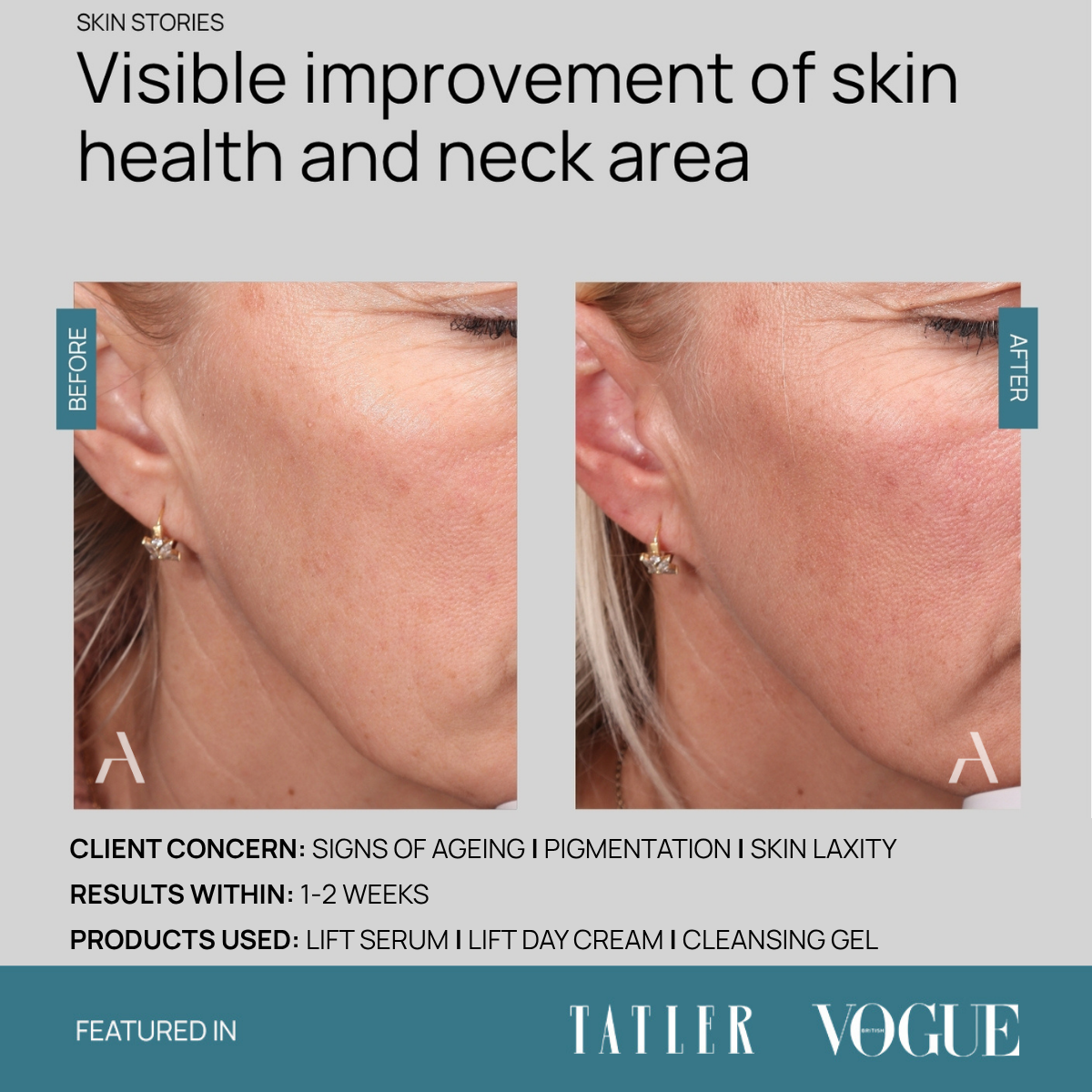 Cleansing Gel
