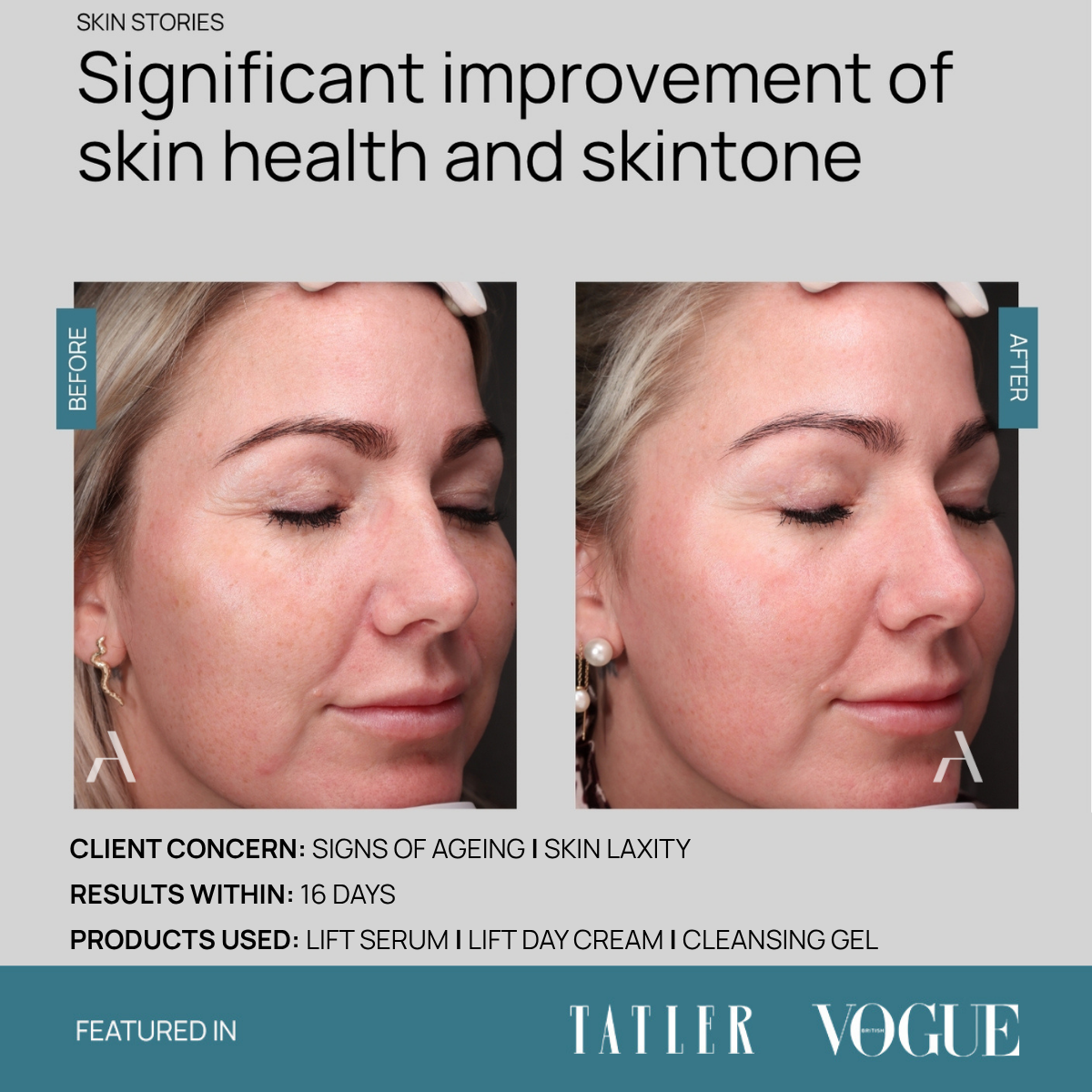 Cleansing Gel
